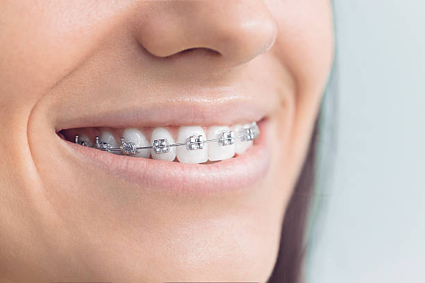 Best Full Mouth Reconstruction  in Milpitas, CA
